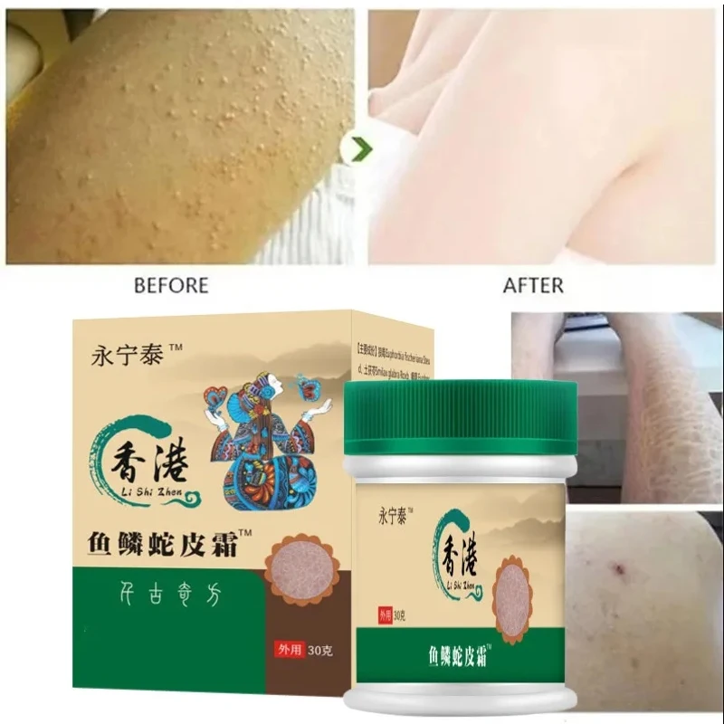 إزالة غسول الجسم لبشرة الدجاج ، وتحسين المسام ، وإزالة الجلد الميت ، وتبييض وترطيب ، ومنتجات العناية بالجسم - الصورة 3